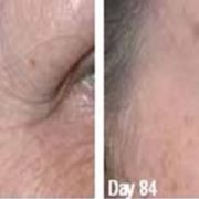 Youth Cream Anti-wrinkle with 4% Ubiquinone Coq10, 20% Argireline Also Has , DMAE, Syncoll (peptides), Hyaluronic Acid, Pepha-tight and much more. PARABEN FREE 1 oz/30ml.